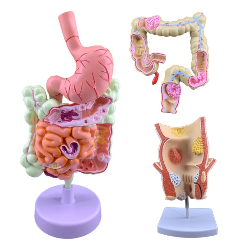 Q6PA Modello didattico patolog - Medical Lab Observer recensione e prezzo