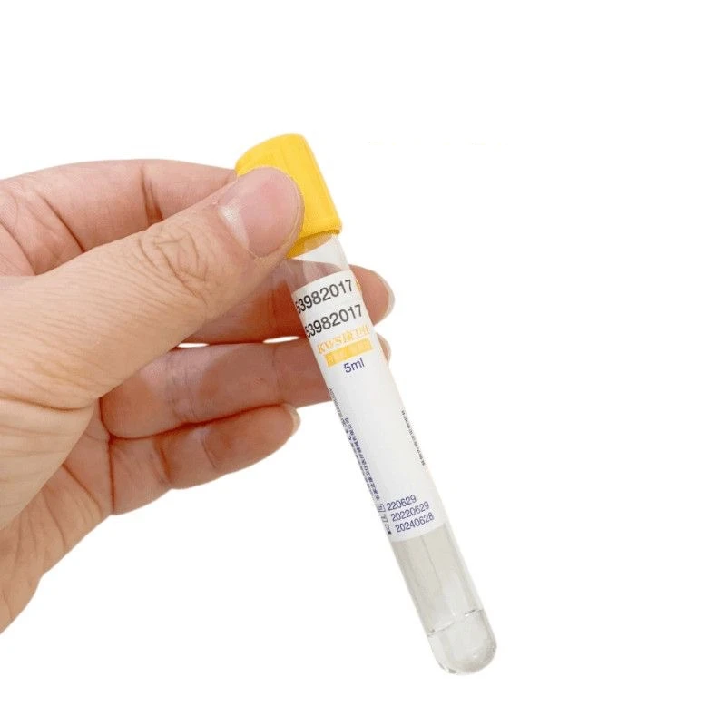 Tubo monouso per la raccolta d - Medical Lab Blood Test recensione e prezzo
